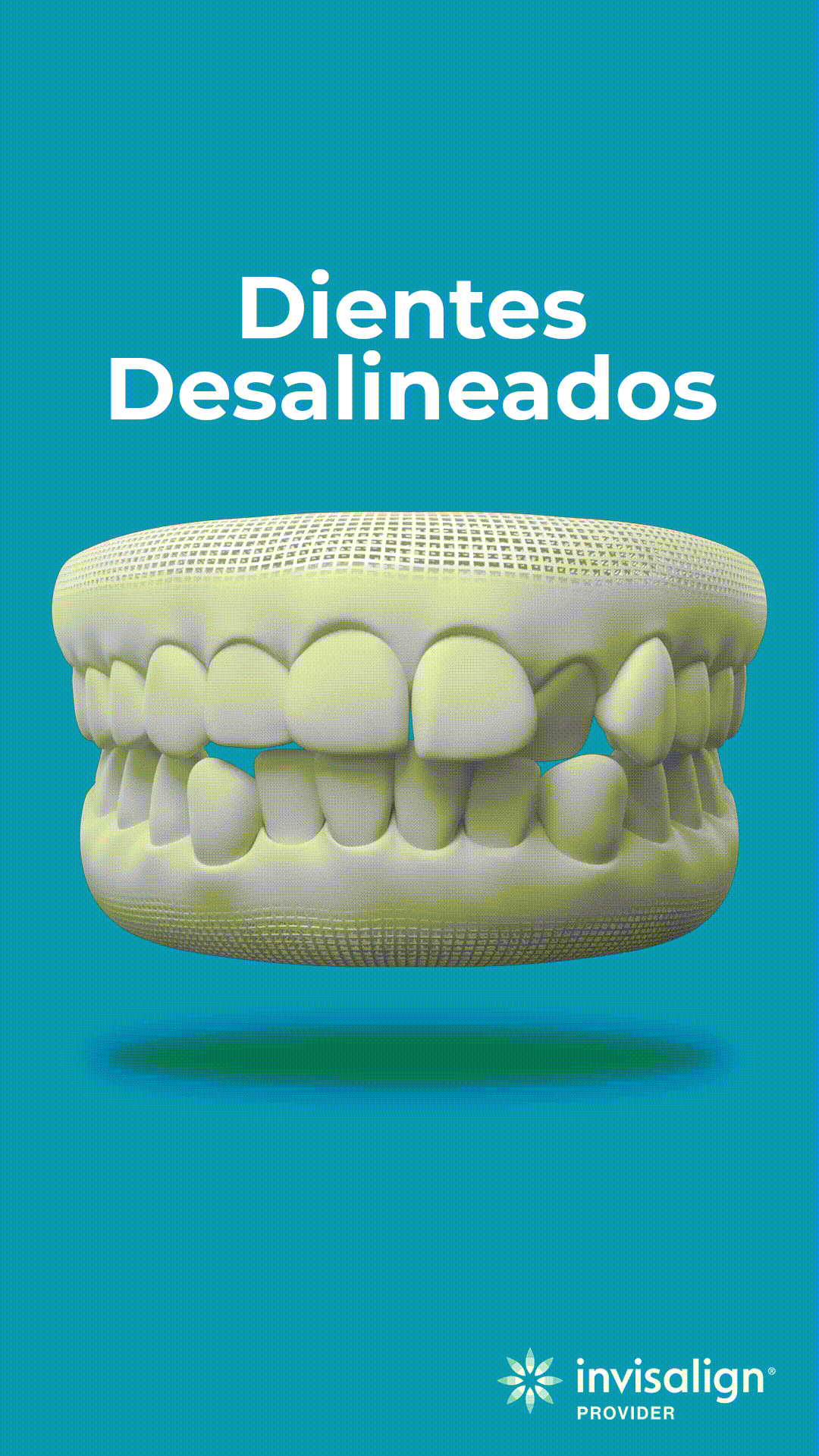 Diente desalineado copia
