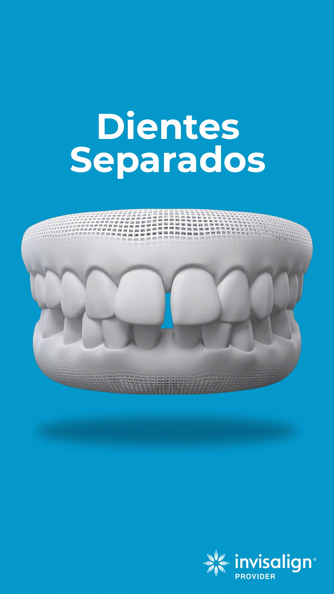 Dientes separados copia