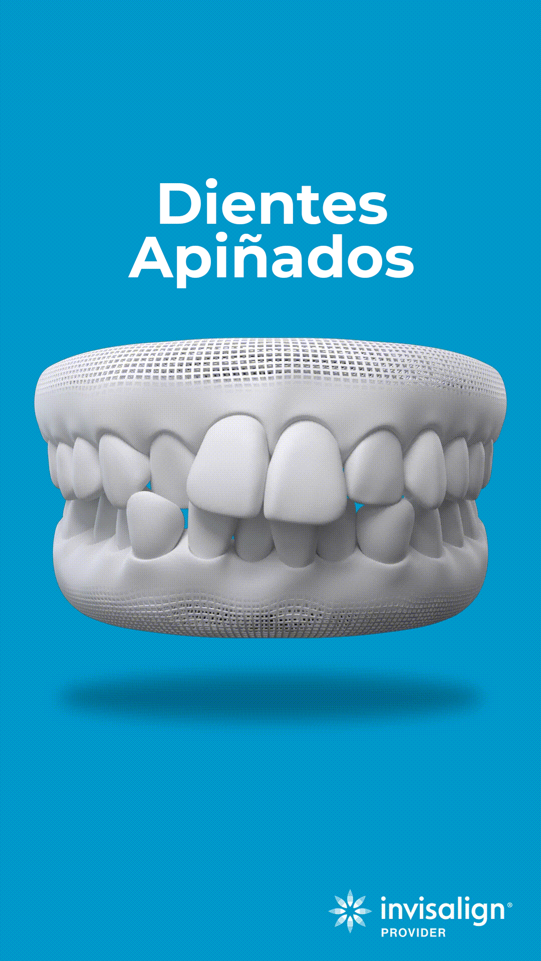 dientes apiñados copia
