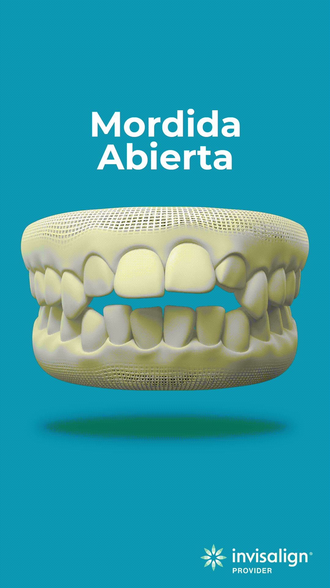 mordida abierta copia