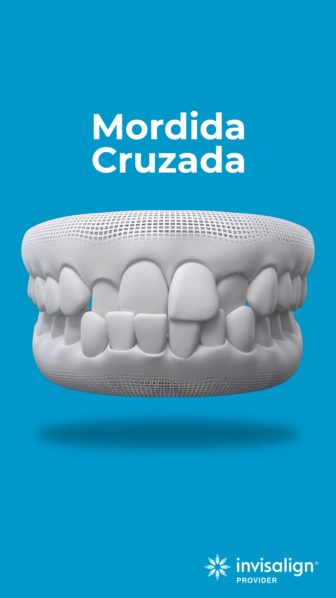 mordida cruzada copia
