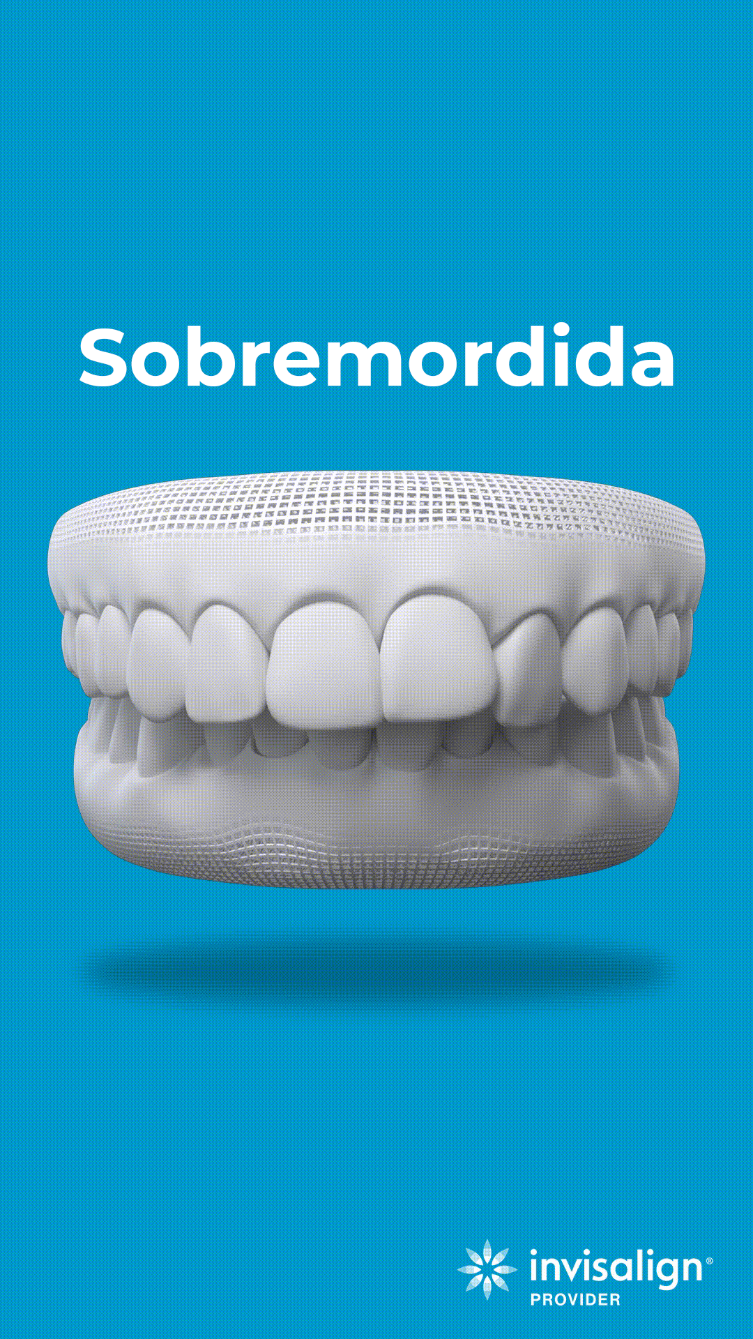 sobremordida copia