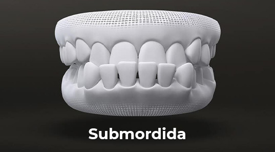 submordida